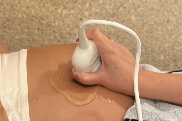 Mãos da médica operando a sonda do equipamento de imagem sobre a barriga de uma mulher grávida.
